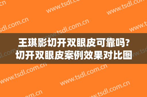 王琪影切开双眼皮可靠吗?切开双眼皮案例效果对比图_郑州大学第一附属医院