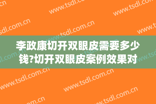 李政康切开双眼皮需要多少钱?切开双眼皮案例效果对比图_上海交通大学医学院附属第九人民医院