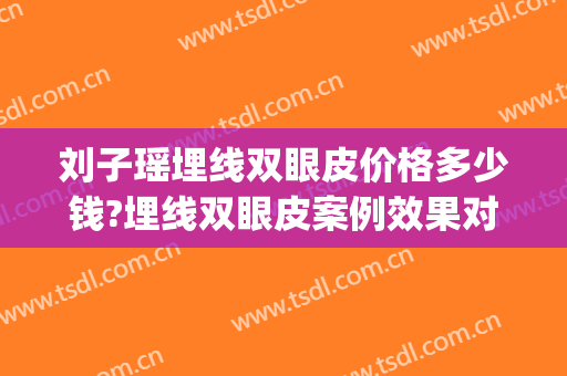 刘子瑶埋线双眼皮价格多少钱?埋线双眼皮案例效果对比图_西安交通大学第二附属医院