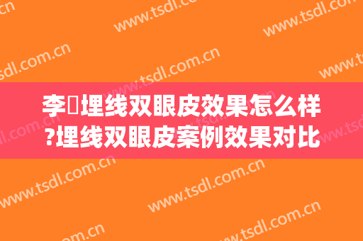 李喆埋线双眼皮效果怎么样?埋线双眼皮案例效果对比图_陆军军医大学第一附属医院(重庆西南医院)