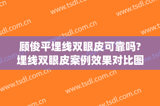 顾俊平埋线双眼皮可靠吗?埋线双眼皮案例效果对比图_天津市天津医院