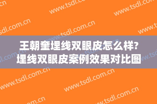 王朝奎埋线双眼皮怎么样?埋线双眼皮案例效果对比图_重庆医科大学附属第一医院