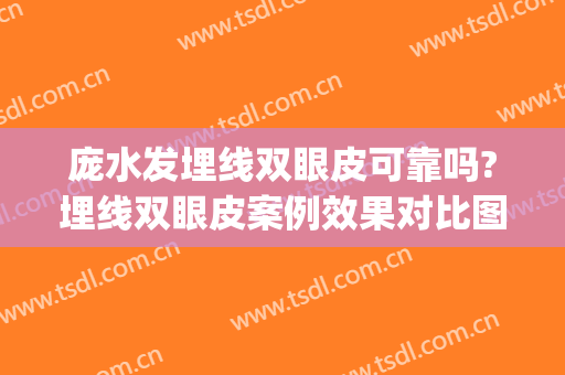 庞水发埋线双眼皮可靠吗?埋线双眼皮案例效果对比图_中山大学附属第一医院