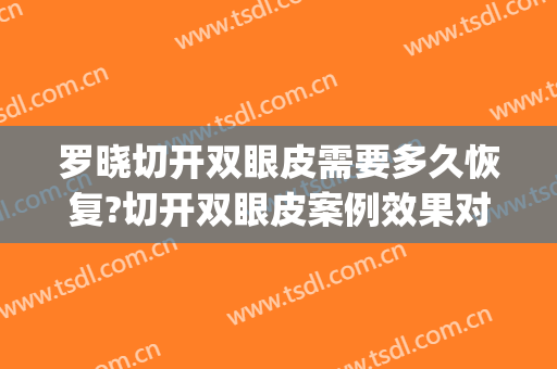 罗晓切开双眼皮需要多久恢复?切开双眼皮案例效果对比图_华中科技大学同济医学院附属同济医院