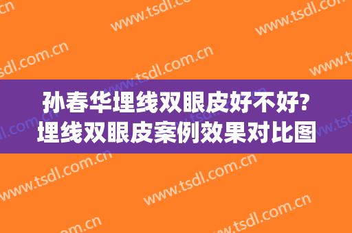 孙春华埋线双眼皮好不好?埋线双眼皮案例效果对比图_天津市眼科医院