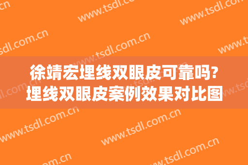 徐靖宏埋线双眼皮可靠吗?埋线双眼皮案例效果对比图_浙江大学医学院附属第一医院