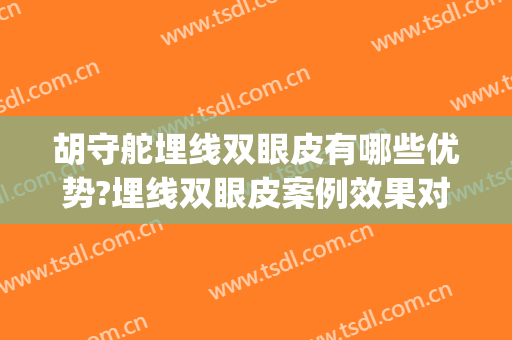 胡守舵埋线双眼皮有哪些优势?埋线双眼皮案例效果对比图_北京中西医结合医院