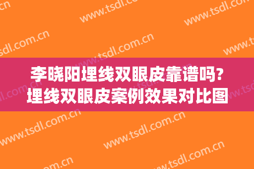 李晓阳埋线双眼皮靠谱吗?埋线双眼皮案例效果对比图_温州医科大学附属第二医院
