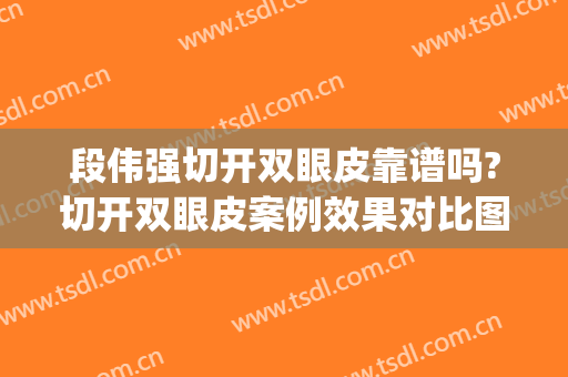 段伟强切开双眼皮靠谱吗?切开双眼皮案例效果对比图_四川大学华西医院