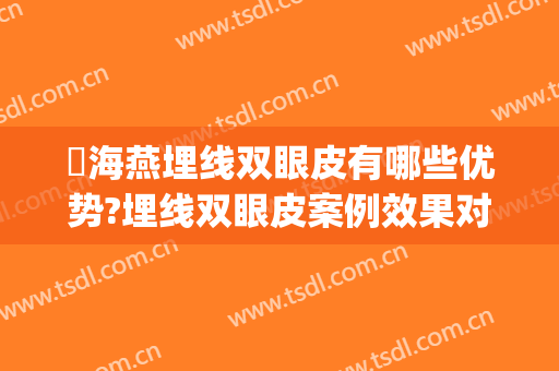 侴海燕埋线双眼皮有哪些优势?埋线双眼皮案例效果对比图_河南省人民医院