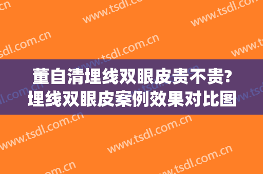 董自清埋线双眼皮贵不贵?埋线双眼皮案例效果对比图_南方医科大学南方医院
