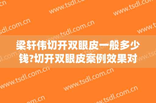 梁轩伟切开双眼皮一般多少钱?切开双眼皮案例效果对比图_中山大学中山眼科中心