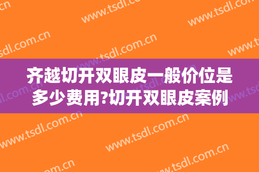 齐越切开双眼皮一般价位是多少费用?切开双眼皮案例效果对比图_中国医学科学院整形外科医院