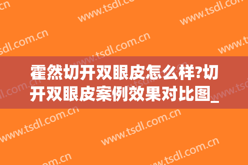 霍然切开双眼皮怎么样?切开双眼皮案例效果对比图_山东省立医院(公立医院切双眼皮)