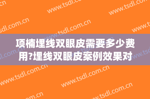 项楠埋线双眼皮需要多少费用?埋线双眼皮案例效果对比图_好大夫工作室