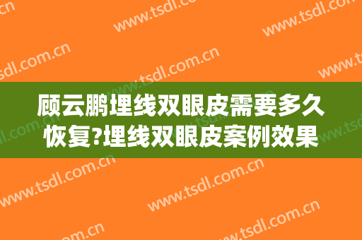 顾云鹏埋线双眼皮需要多久恢复?埋线双眼皮案例效果对比图_中国医学科学院整形外科医院