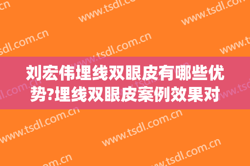 刘宏伟埋线双眼皮有哪些优势?埋线双眼皮案例效果对比图_暨南大学附属第一医院