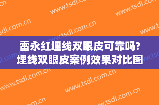 雷永红埋线双眼皮可靠吗?埋线双眼皮案例效果对比图_中国人民解放军总医院第一医学中心