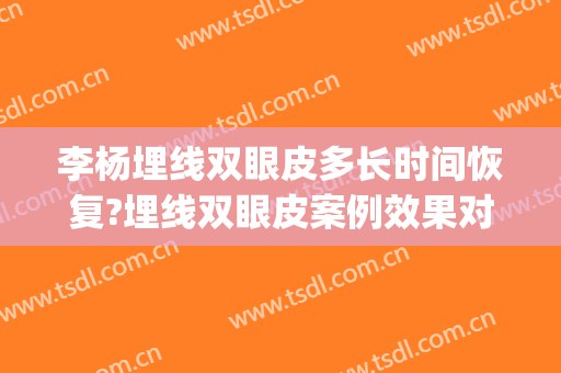 李杨埋线双眼皮多长时间恢复?埋线双眼皮案例效果对比图_西京医院(埋线双眼皮手术过程多长时间)