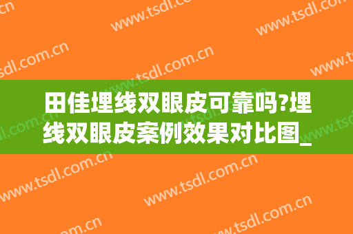 田佳埋线双眼皮可靠吗?埋线双眼皮案例效果对比图_中国医学科学院整形外科医院