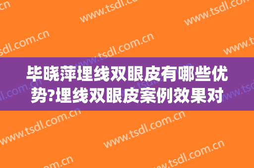 毕晓萍埋线双眼皮有哪些优势?埋线双眼皮案例效果对比图_上海交通大学医学院附属第九人民医院