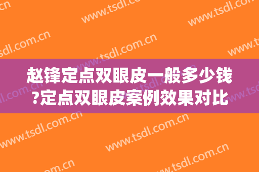 赵锋定点双眼皮一般多少钱?定点双眼皮案例效果对比图_临沂市人民医院