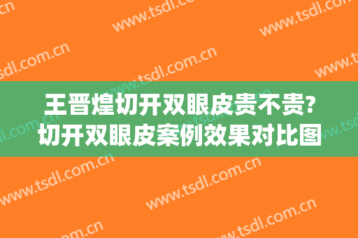 王晋煌切开双眼皮贵不贵?切开双眼皮案例效果对比图_南方医科大学珠江医院