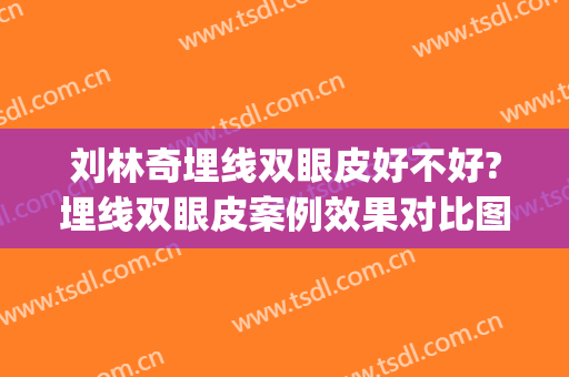 刘林奇埋线双眼皮好不好?埋线双眼皮案例效果对比图_陆军军医大学第一附属医院(重庆西南医院)