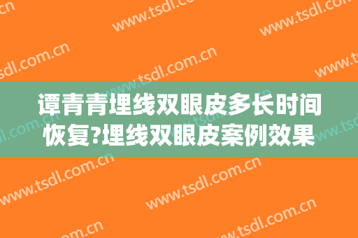 谭青青埋线双眼皮多长时间恢复?埋线双眼皮案例效果对比图_川北医学院附属医院