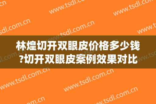 林煌切开双眼皮价格多少钱?切开双眼皮案例效果对比图_首都医科大学附属北京安贞医院