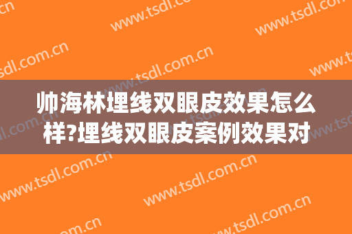 帅海林埋线双眼皮效果怎么样?埋线双眼皮案例效果对比图_天津市中医药研究院附属医院