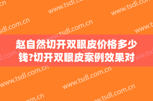 赵自然切开双眼皮价格多少钱?切开双眼皮案例效果对比图_吉林大学第一医院二部