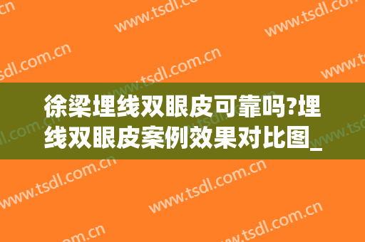 徐梁埋线双眼皮可靠吗?埋线双眼皮案例效果对比图_上海交通大学医学院附属第九人民医院