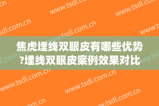焦虎埋线双眼皮有哪些优势?埋线双眼皮案例效果对比图_中国医学科学院整形外科医院