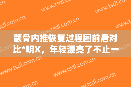 颧骨内推恢复过程图前后对比*明X，年轻漂亮了不止一点点(颧骨内推可以恢复原来状态吗)