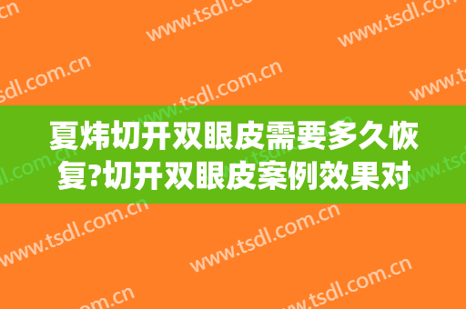 夏炜切开双眼皮需要多久恢复?切开双眼皮案例效果对比图_好大夫工作室
