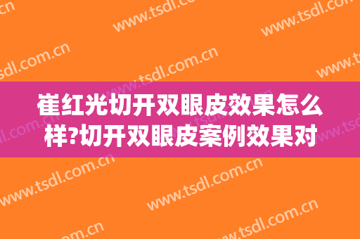 崔红光切开双眼皮效果怎么样?切开双眼皮案例效果对比图_浙江大学医学院附属第一医院
