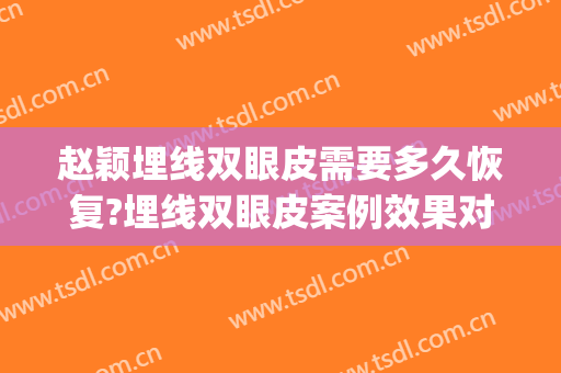 赵颖埋线双眼皮需要多久恢复?埋线双眼皮案例效果对比图_好大夫工作室
