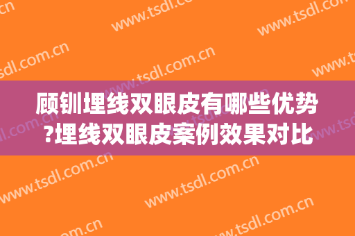 顾钏埋线双眼皮有哪些优势?埋线双眼皮案例效果对比图_上海交通大学医学院附属第九人民医院北部院区