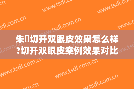朱鴷切开双眼皮效果怎么样?切开双眼皮案例效果对比图_上海长征医院