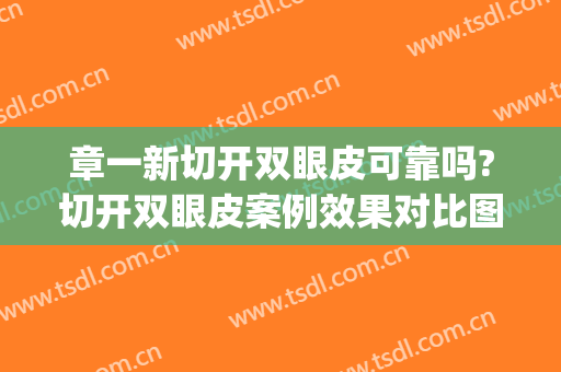 章一新切开双眼皮可靠吗?切开双眼皮案例效果对比图_上海交通大学医学院附属第九人民医院