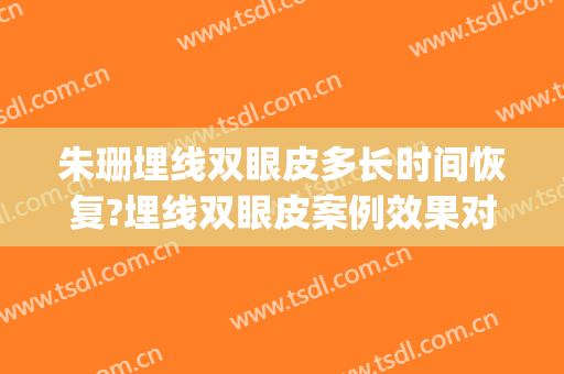 朱珊埋线双眼皮多长时间恢复?埋线双眼皮案例效果对比图_中国医学科学院整形外科医院