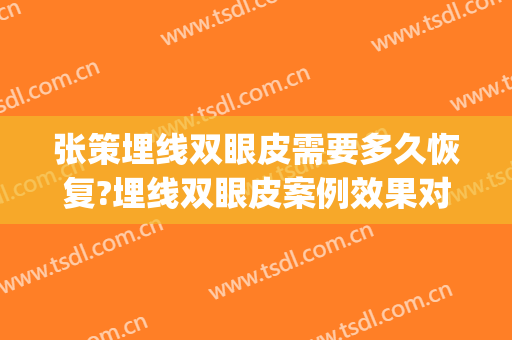 张策埋线双眼皮需要多久恢复?埋线双眼皮案例效果对比图_浙江省人民医院