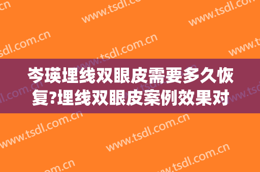 岑瑛埋线双眼皮需要多久恢复?埋线双眼皮案例效果对比图_四川大学华西医院