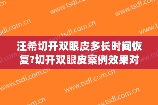 汪希切开双眼皮多长时间恢复?切开双眼皮案例效果对比图_上海交通大学医学院附属第九人民医院