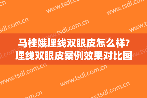 马桂娥埋线双眼皮怎么样?埋线双眼皮案例效果对比图_中国医学科学院整形外科医院