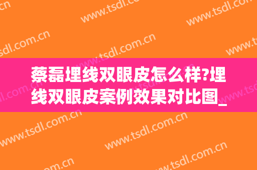 蔡磊埋线双眼皮怎么样?埋线双眼皮案例效果对比图_中国医学科学院整形外科医院