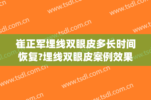 崔正军埋线双眼皮多长时间恢复?埋线双眼皮案例效果对比图_郑州大学第一附属医院