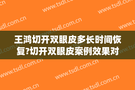 王鸿切开双眼皮多长时间恢复?切开双眼皮案例效果对比图_山东省立医院