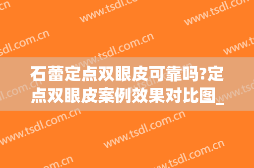 石蕾定点双眼皮可靠吗?定点双眼皮案例效果对比图_中国医学科学院整形外科医院